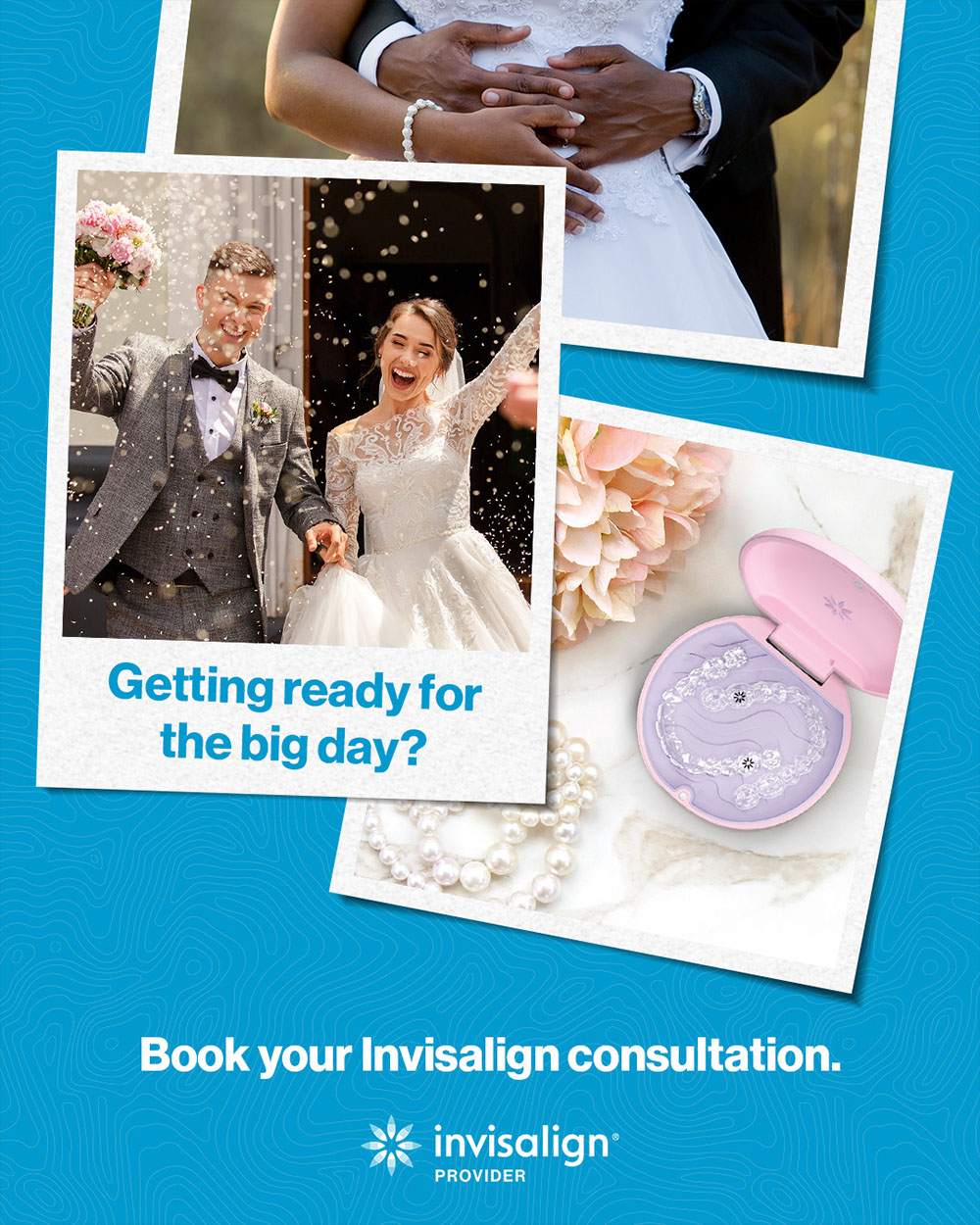 Invisalign for brides